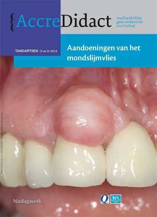 Aandoeningen van het mondslijmvlies