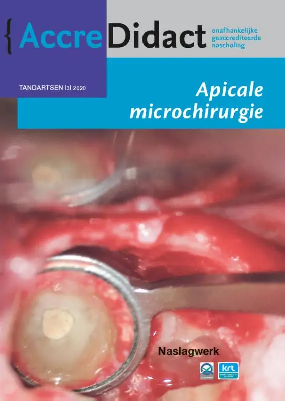 Apicale microchirurgie